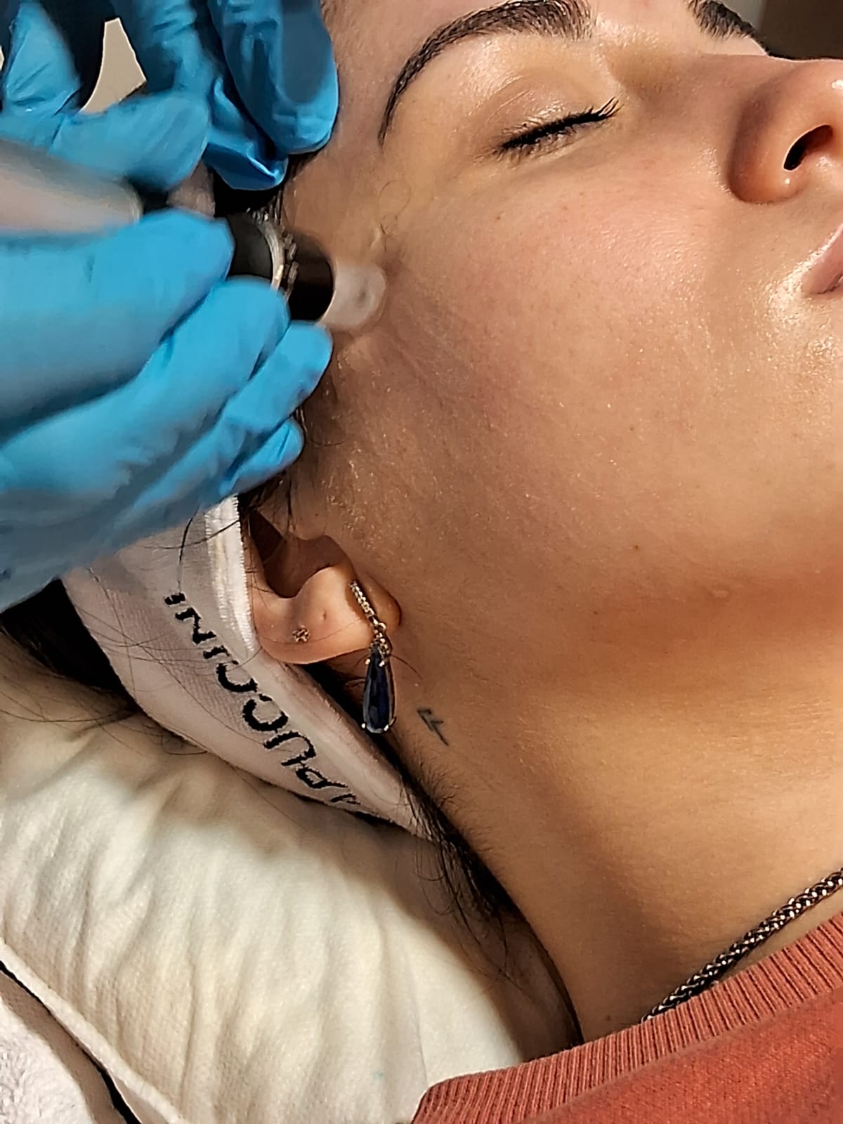 Taller de Microneedling: Hidratación y Rejuvenecimiento - galería 1